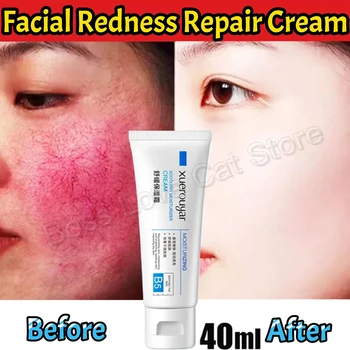7-дневный восстанавливающий крем от покраснения лица, успокаивающий восстанавливающий покраснение кожи, розацеа, красная кровь, улучшающий чувствительную кожу, уход за кожей Korean Cosmetic, 40 мл