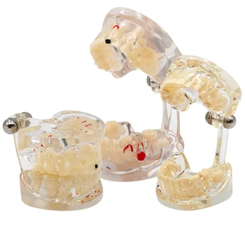 1шт Модель зубов Детская Молочная Постоянная Чередующаяся Модель Детское постоянное исследование Стандартная Модель зубов студента-стоматолога